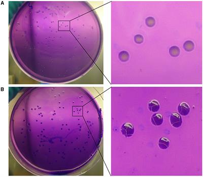 Investigating the mechanism of rough phenotype in a naturally attenuated Brucella strain: insights from whole genome sequencing